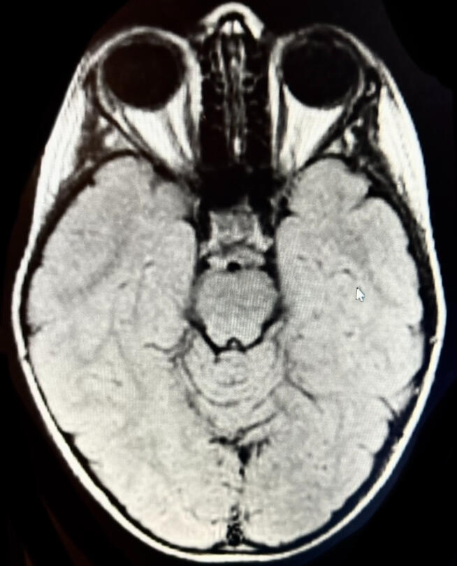1818 VS. 1831 DIFFERENCES